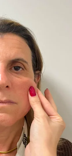 Depois do ultrassom micro e macrofocado - caso 1